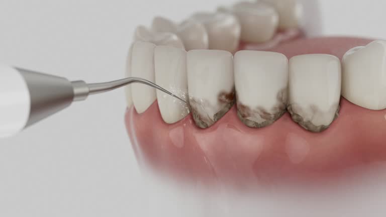 Reliable Dental Implants contractor in Edgewood, PA by Smile Center Dentistry